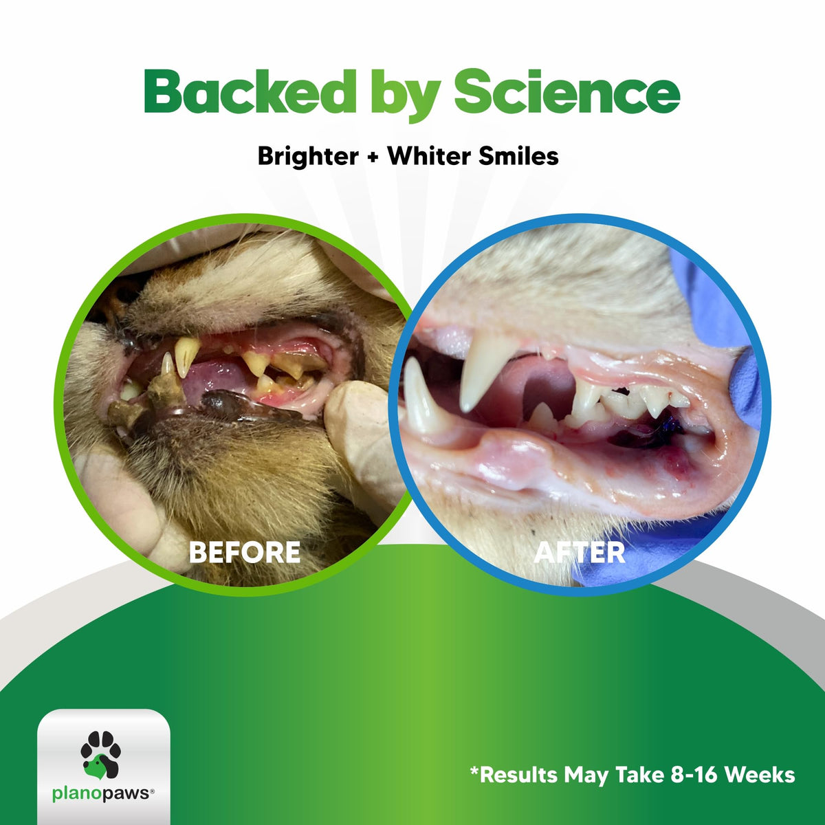Dental Powder for Teeth Cleaning X156